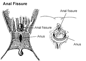 dorothy hallman recommends Anal And Swallowing