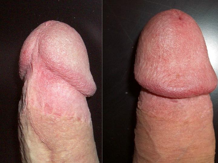 Best of Penis bilder