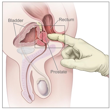 dhanashri kulkarni recommends solo prostate milking pic