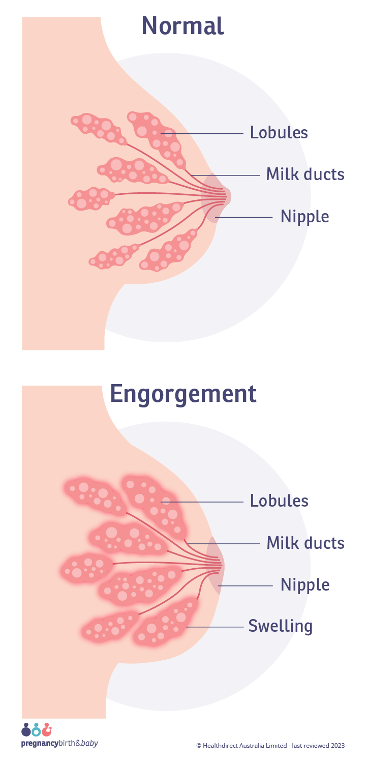 abdullah al rashideh recommends giant boobs lactating pic