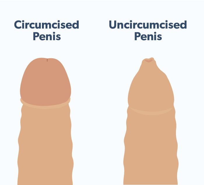 abby dingman recommends Uncircumsized Penis Sex