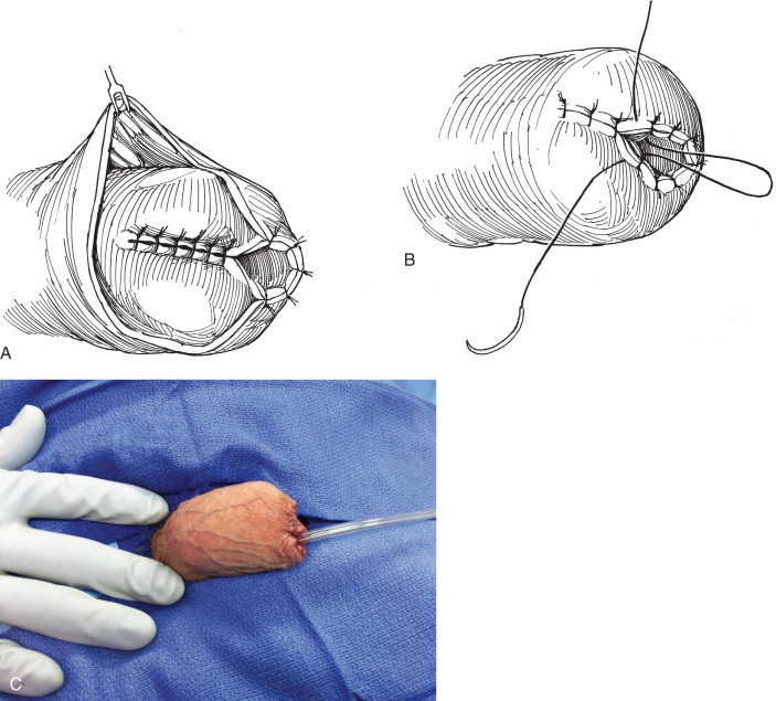 one testical porn