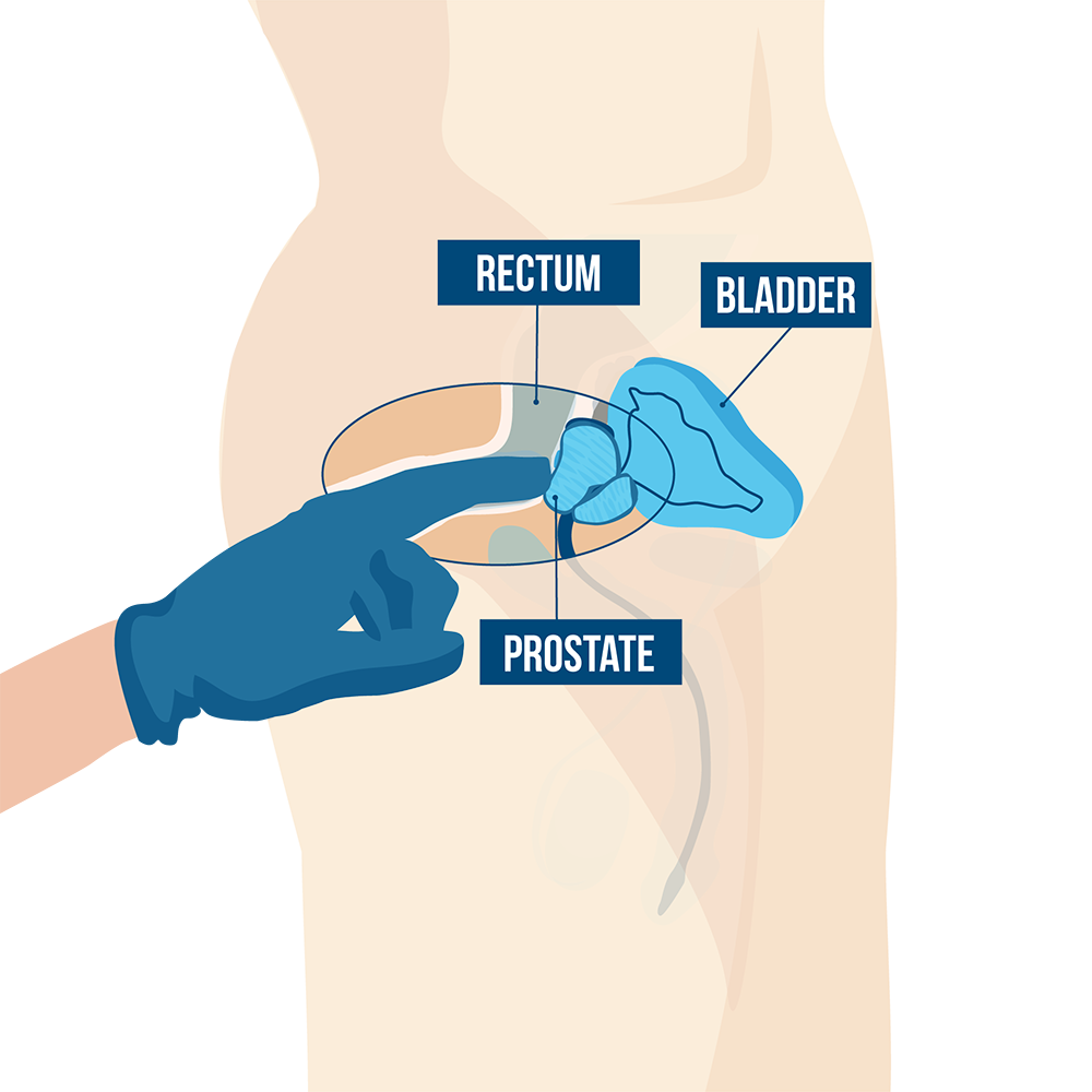 corle snyman recommends Guide To Anal Fisting