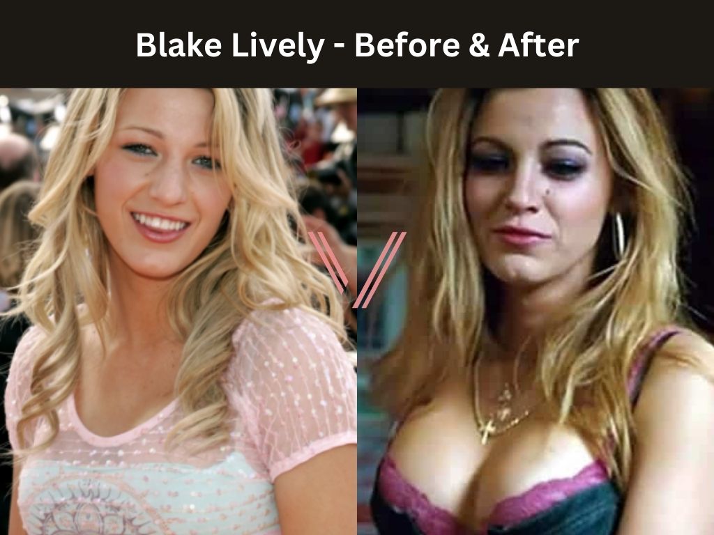 dave hume add blake lively big tits photo