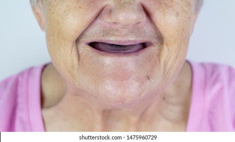 no teeth old lady