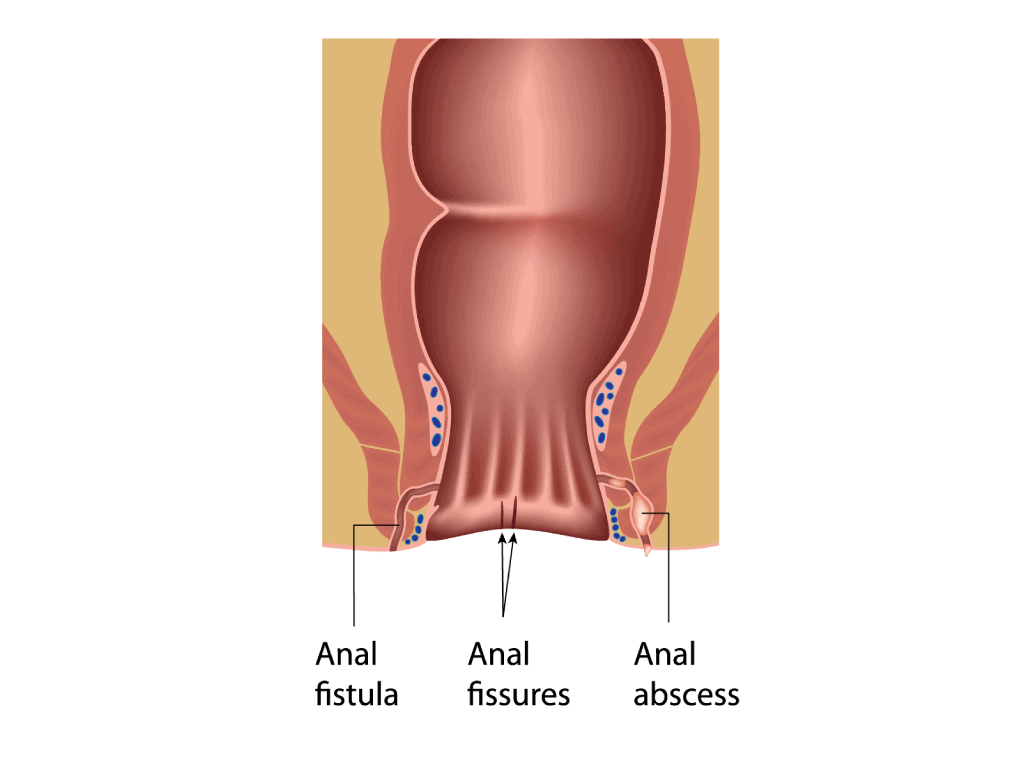 dave ledgard share deep painful anal photos