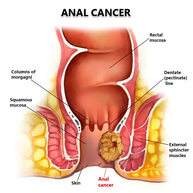 cody hanshew recommends Anal And Swallowing