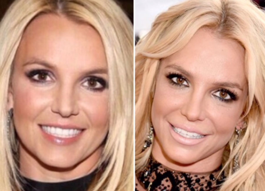 britney braces