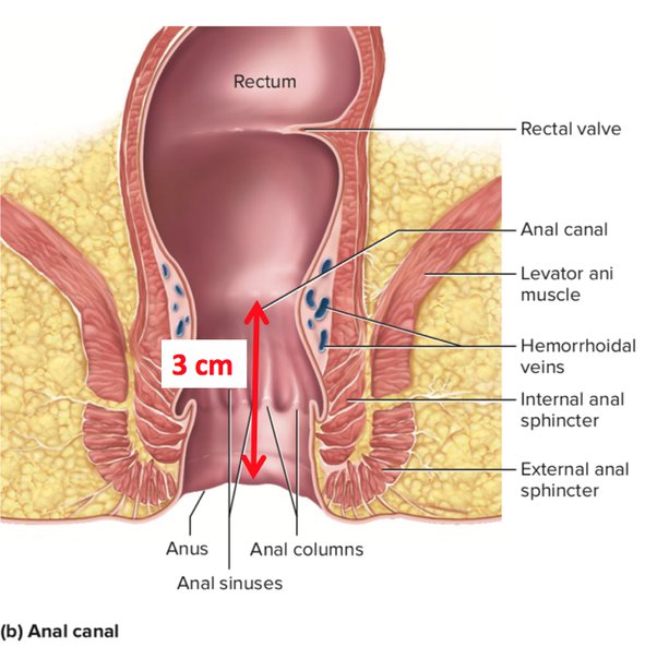 chris giamanco recommends Male Anal Stretch