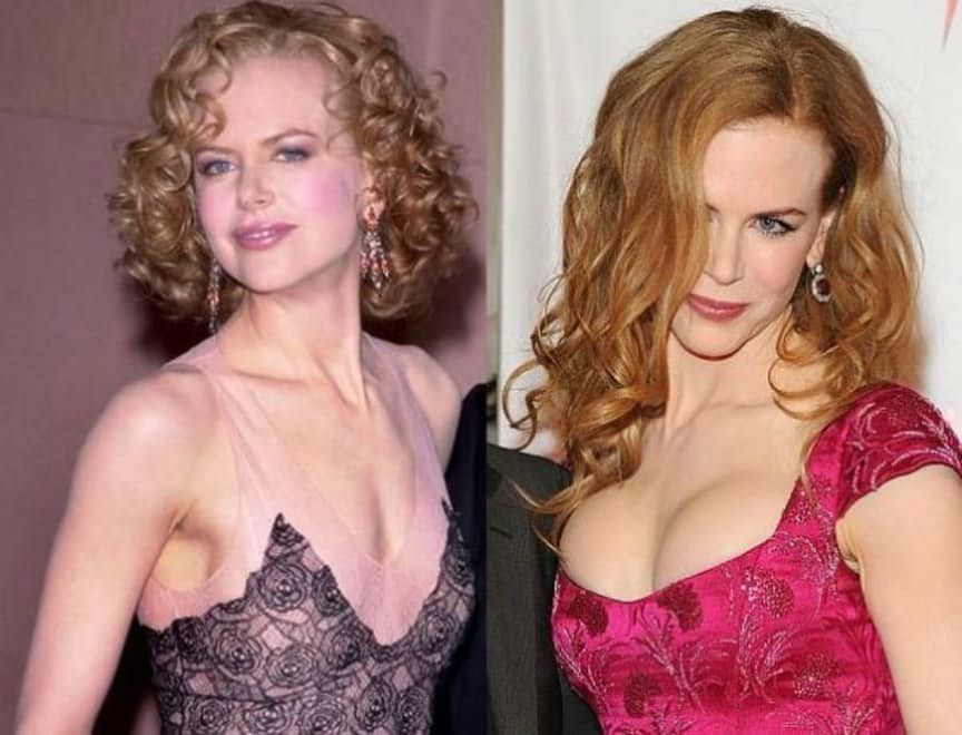 aiza maning recommends Nicole Kidman Tits