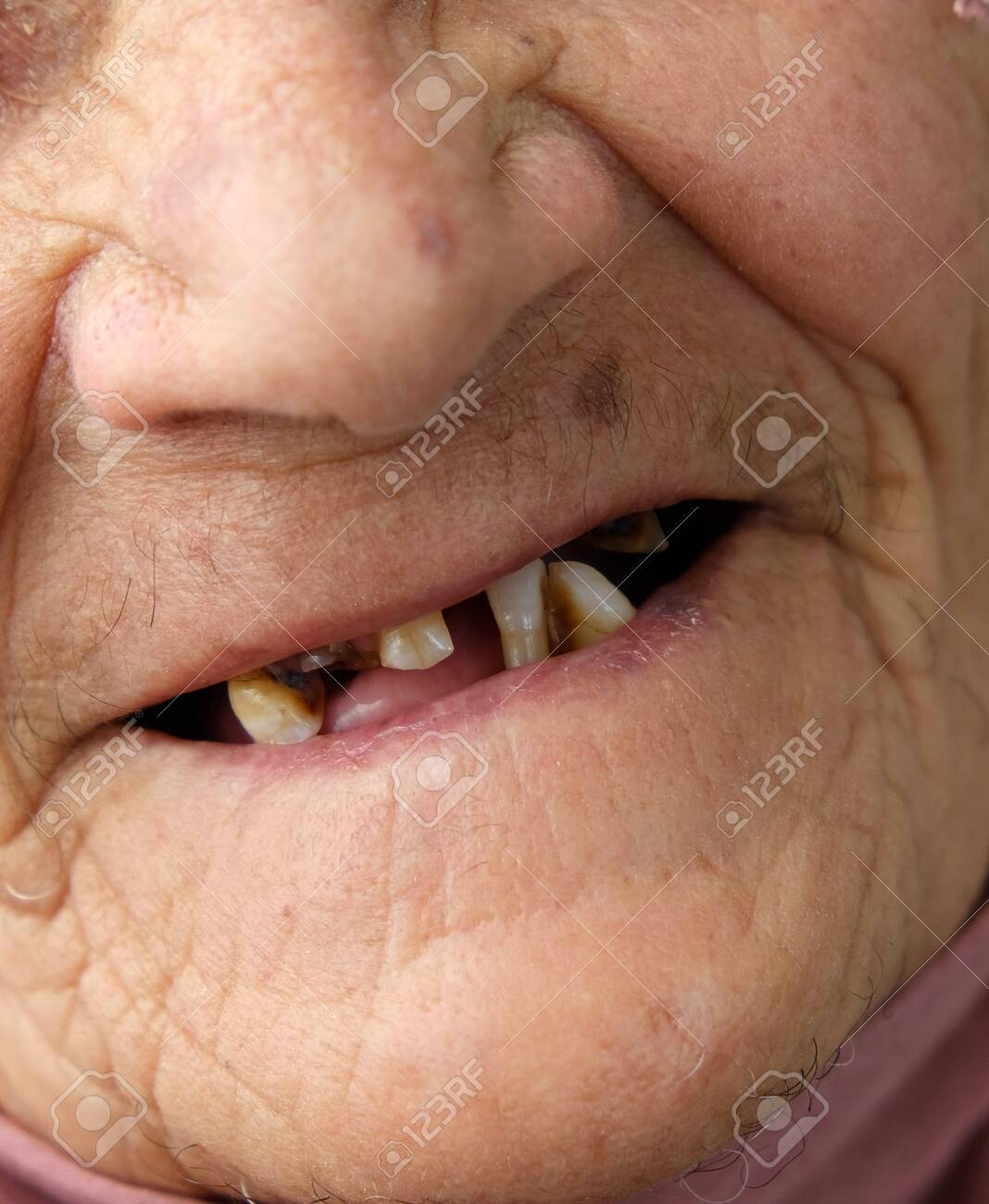 alfred blankson recommends no teeth old lady pic