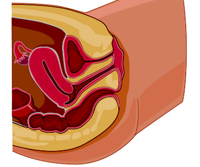 andy cudjoe recommends pelvic exam porn pic